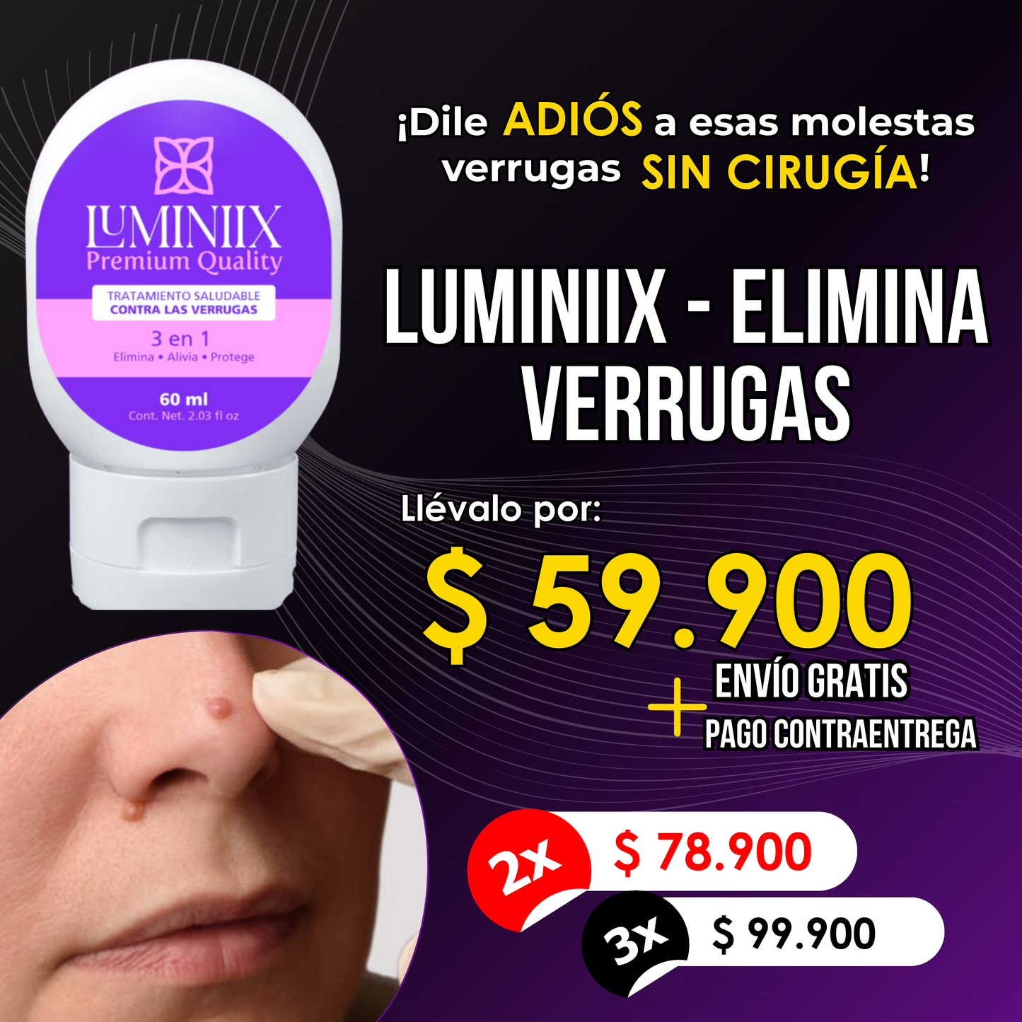 Luminiix - Elimina verrugas rápido y sin dolor